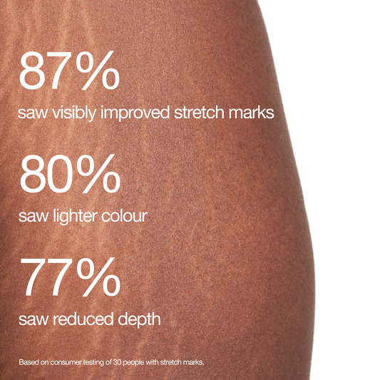 Stretch Mark Treatment Products | Complete Care Kit Designed to Stretch Mark Treatment Products | Complete Care Kit Designed to