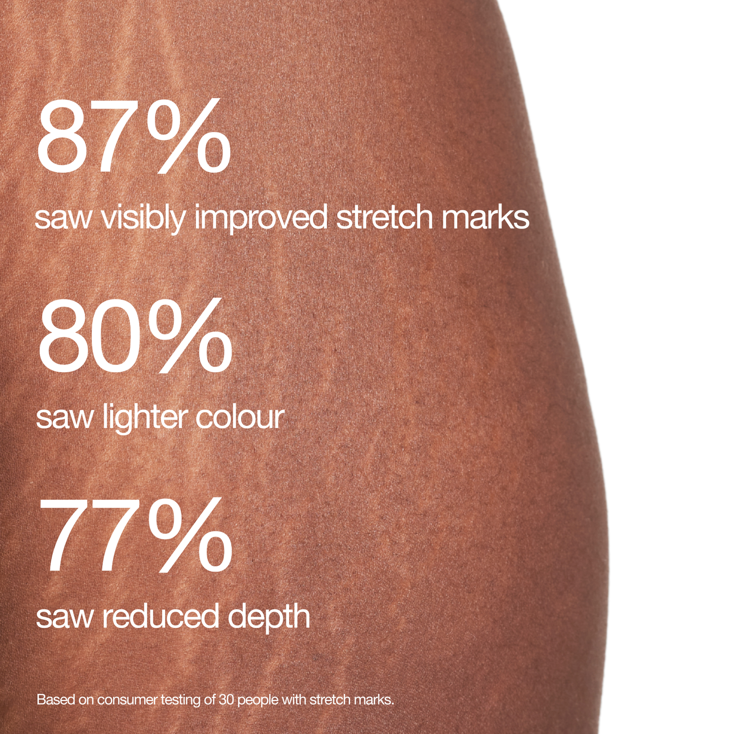 Stretch Mark Programme