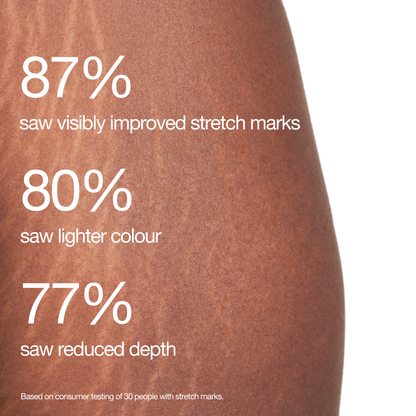 Stretch Mark Programme