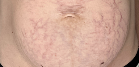 Customer photo before using the Striā Lab programme