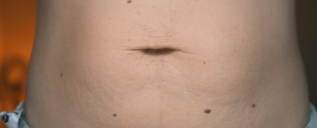 The same customer after using the Striā Lab programme