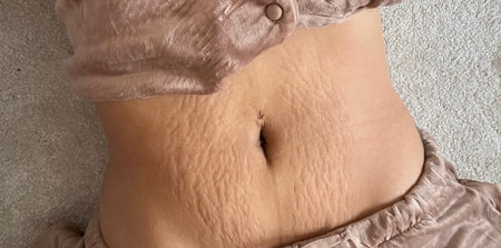Customer photo before using the Striā Lab programme