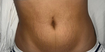 The same customer after using the Striā Lab programme
