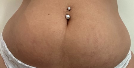 Customer photo before using the Striā Lab programme