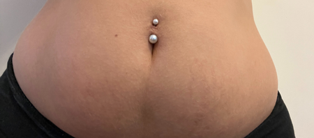 The same customer after using the Striā Lab programme