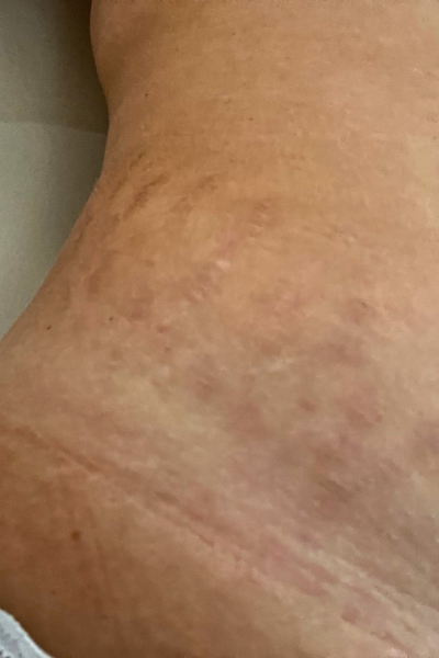Customer photo before using the Striā Lab programme