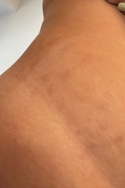 The same customer after using the Striā Lab programme
