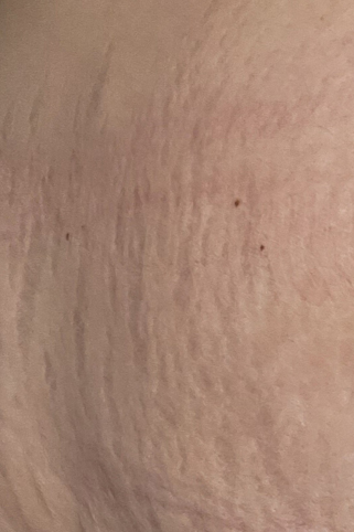 Customer photo before using the Striā Lab programme