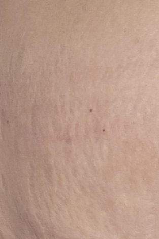 The same customer after using the Striā Lab programme