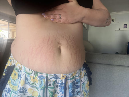 The same customer after using the Striā Lab programme