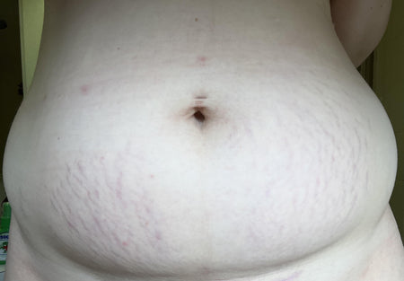 The same customer after using the Striā Lab programme