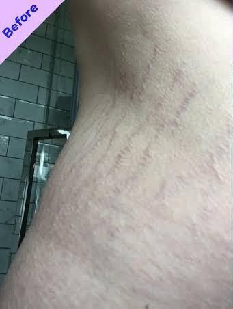 Customer photo before using the Striā Lab programme
