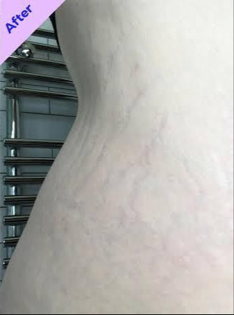 The same customer after using the Striā Lab programme
