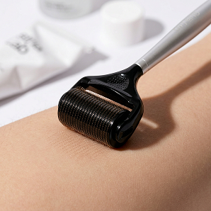Microneedling is one of the few options with evidence