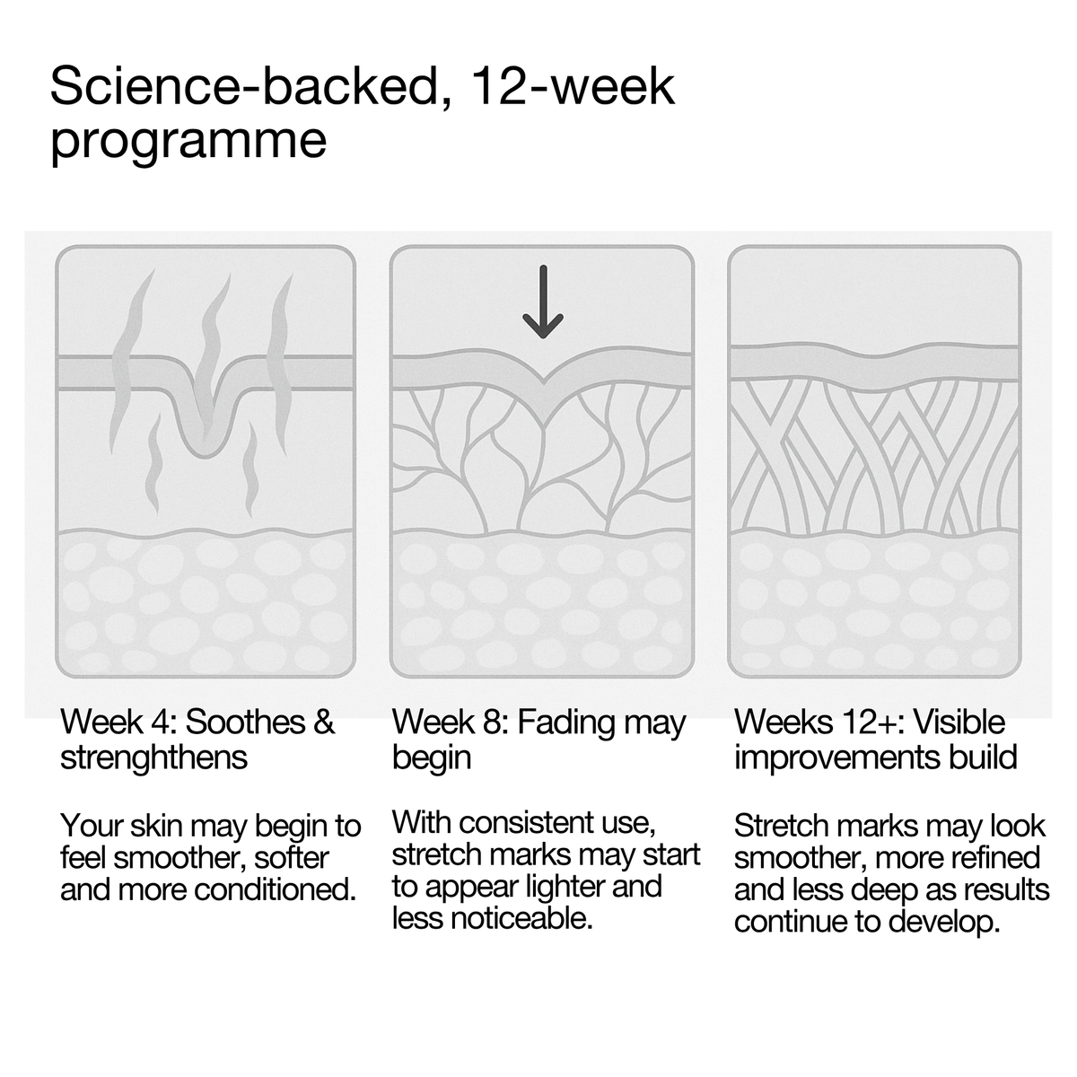 Stretch Mark Programme