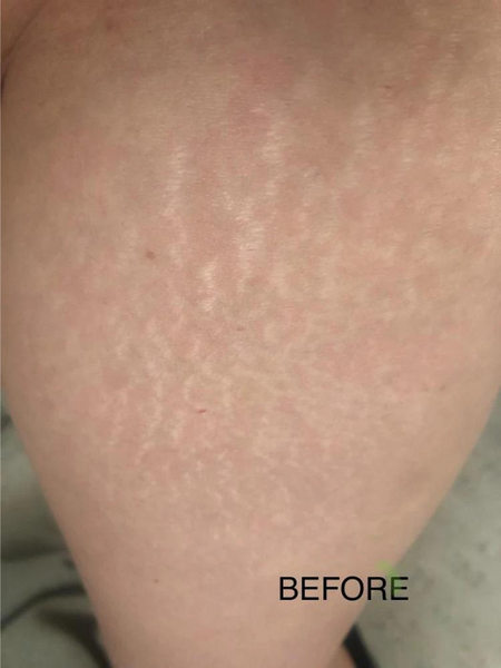 Customer photo before using the Striā Lab programme