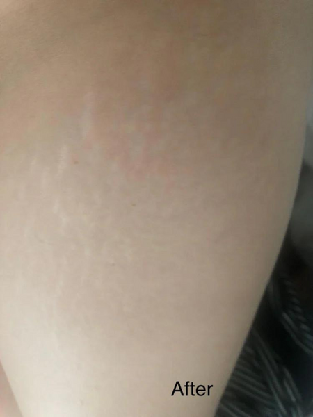 The same customer after using the Striā Lab programme