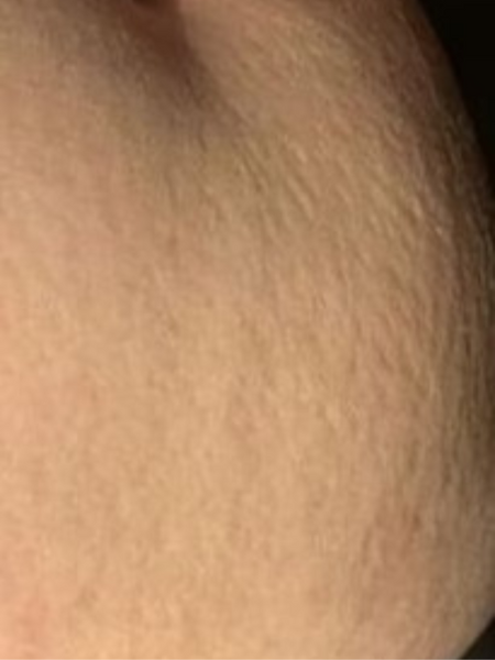 The same customer after using the Striā Lab programme