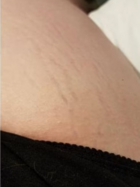 Customer photo before using the Striā Lab programme