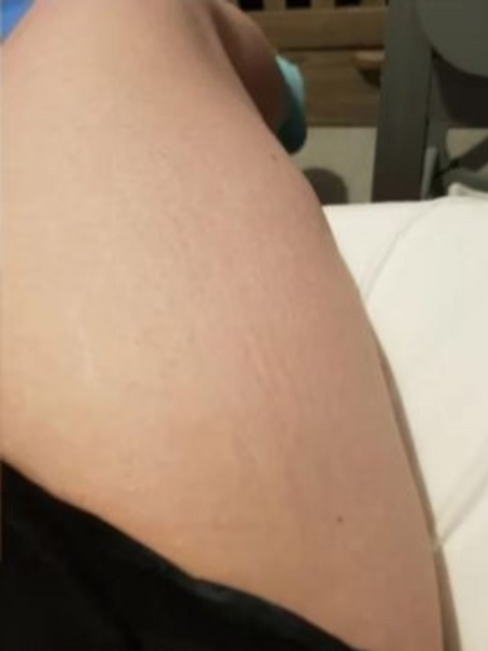 The same customer after using the Striā Lab programme