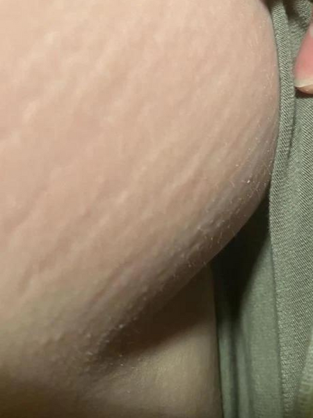 Customer photo before using the Striā Lab programme