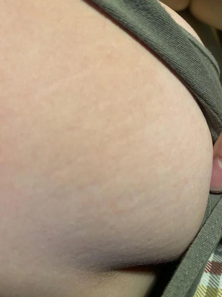 The same customer after using the Striā Lab programme