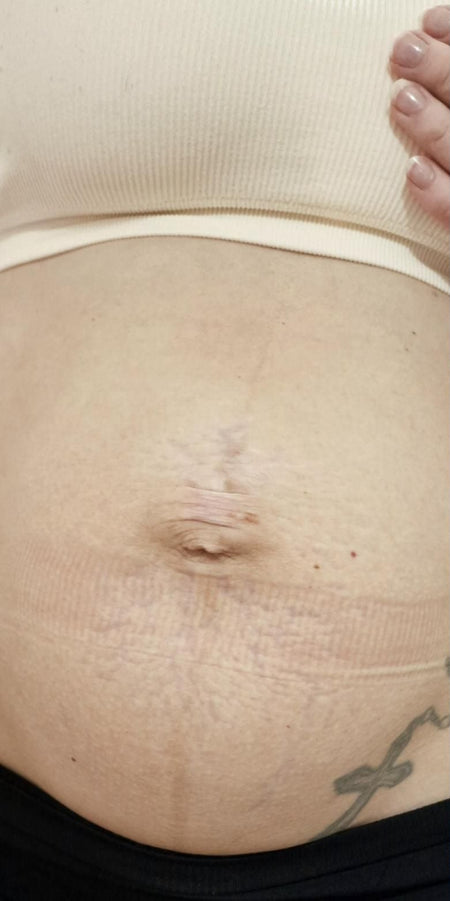 Customer photo before using the Striā Lab programme
