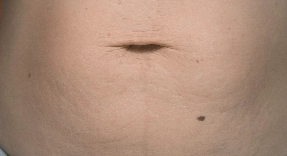 After image