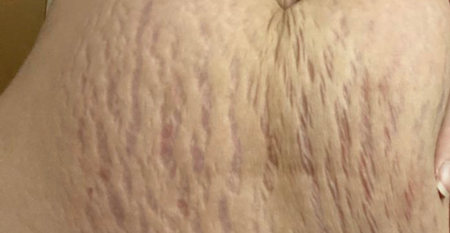 Customer photo before using the Striā Lab programme