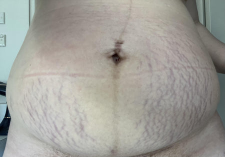 Customer photo before using the Striā Lab programme