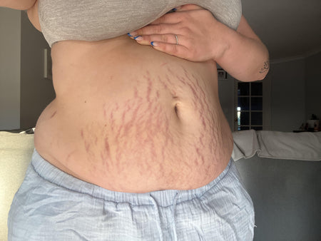 Customer photo before using the Striā Lab programme