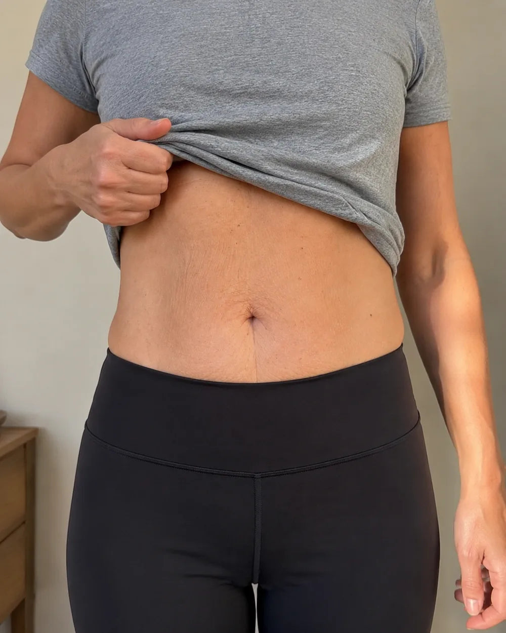 Client-supplied photograph of a woman's abdomen at the start of the programme