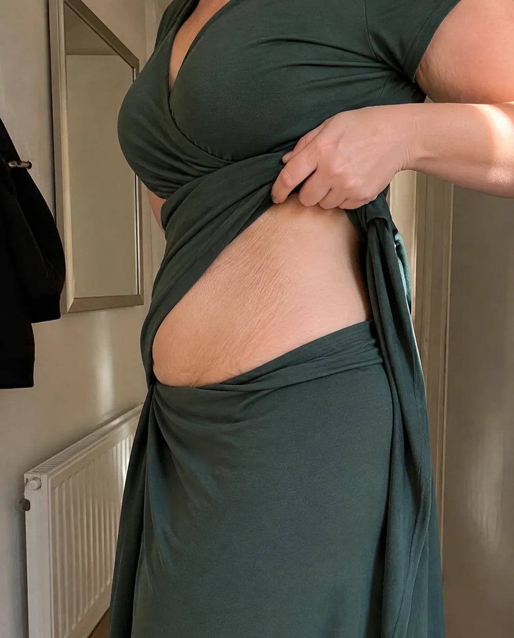 A woman lifting the hem of a green dress to show fine crinkled skin across her stomach