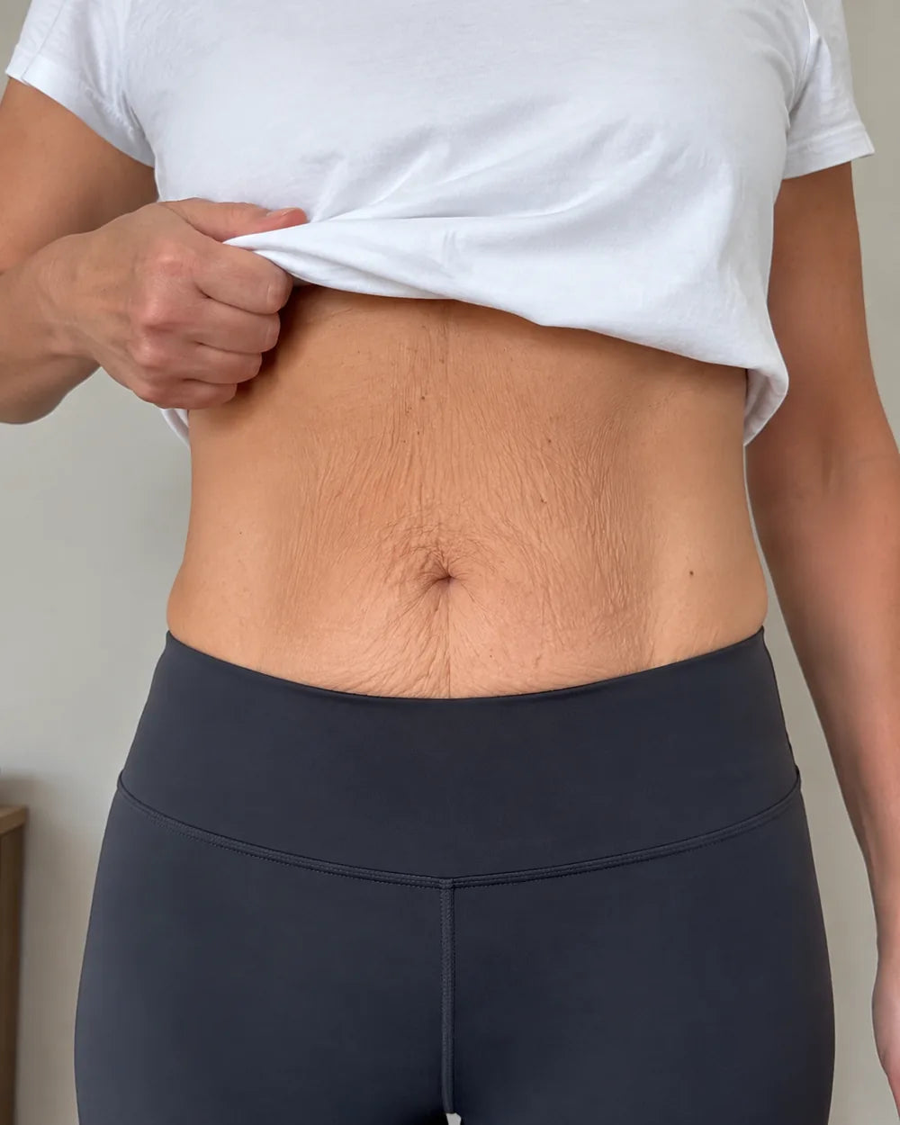 Client-supplied photograph of the same area after completing the twelve-week programme