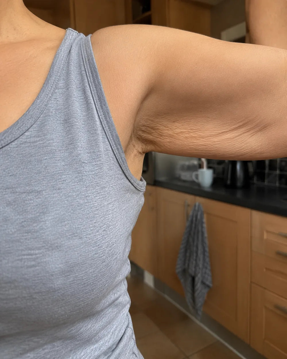 Close view of the skin on a woman's upper arm showing fine crinkled texture along the underside