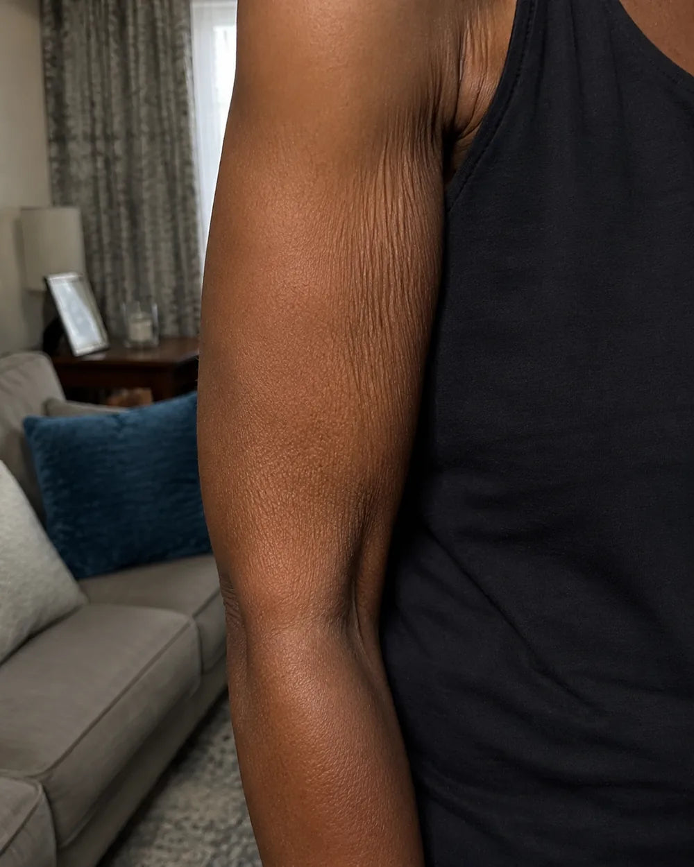 Close view of the skin on a woman's upper arm showing fine crinkled texture