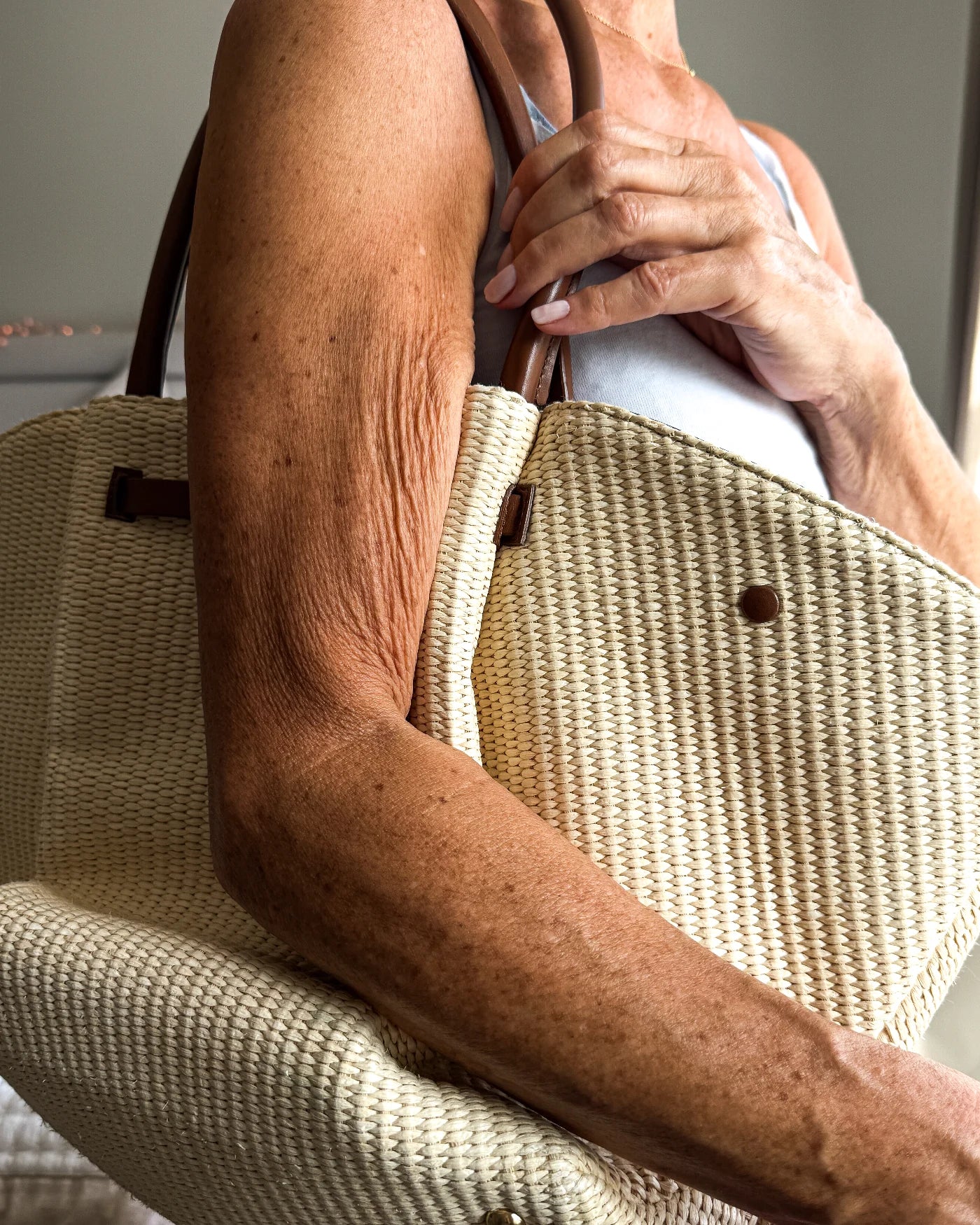 Crepey skin on the upper arm of a woman in her fifties